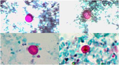 Parasitological, Molecular, and Epidemiological Investigation of Cryptosporidium Infection Among Cattle and Buffalo Calves From Assiut Governorate, Upper Egypt: Current Status and Zoonotic Implications